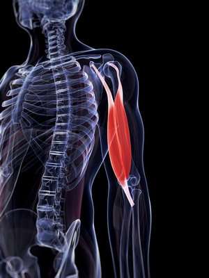 Rupture du tendon long biceps