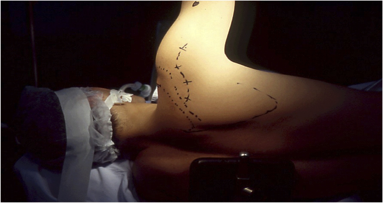 traitement luxations