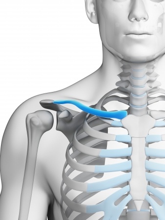 Fractures de la clavicule