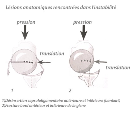 diagnostic luxations