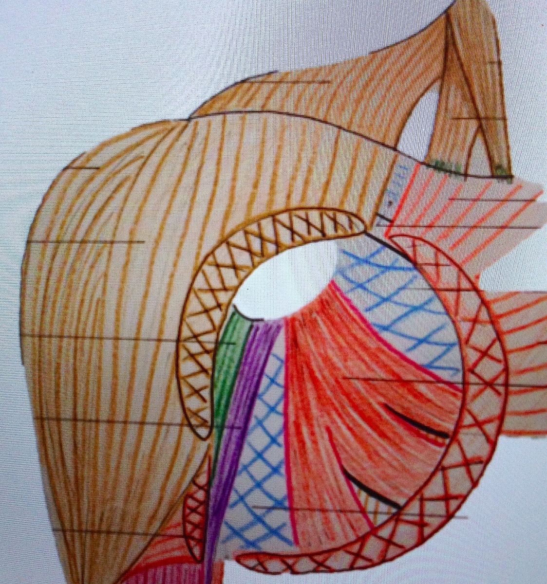 rupture du grand pectoral